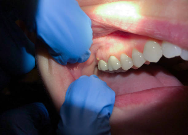 Best Pediatric Emergency Dentist in Rodeo, CA
