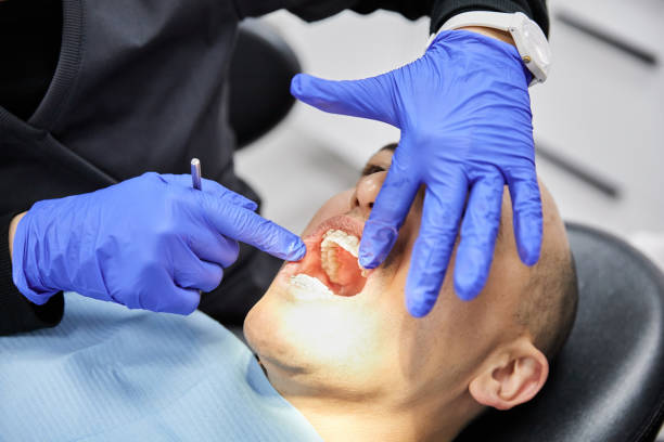 Best Emergency Wisdom Teeth Removal in Rodeo, CA